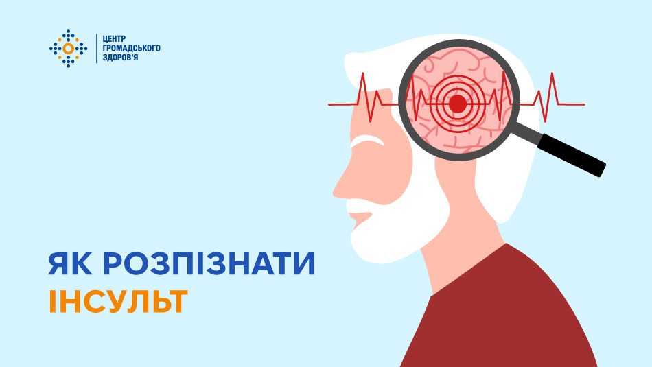 Як розпізнати інсульт